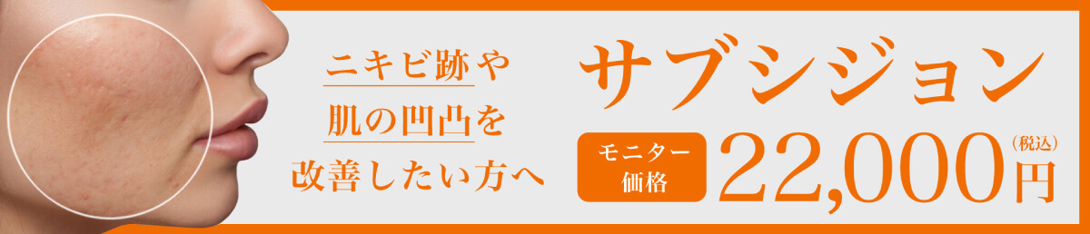 サブシジョン